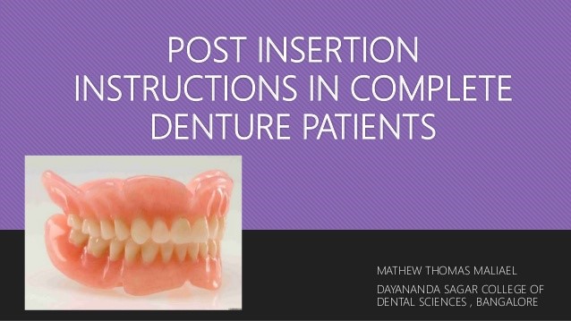 Partial Dentures 
      For Front Teeth Winnetka CA 91396